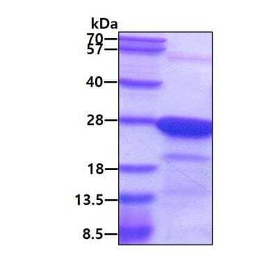 SDS-PAGE: Recombinant Human HN1L His Protein [NBP2-23107]