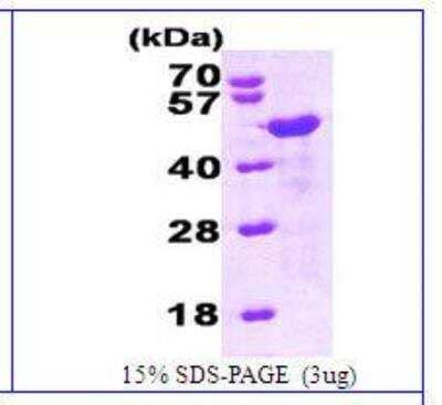 SDS-PAGE: Recombinant Human HOMER1 His Protein [NBC1-26371]