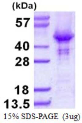 SDS-PAGE: Recombinant Human HOMER2 His Protein [NBP1-99043]