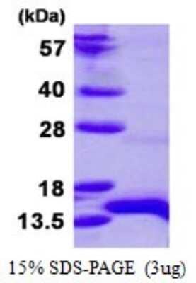 SDS-PAGE: Recombinant Human HOP His Protein [NBP1-98893]