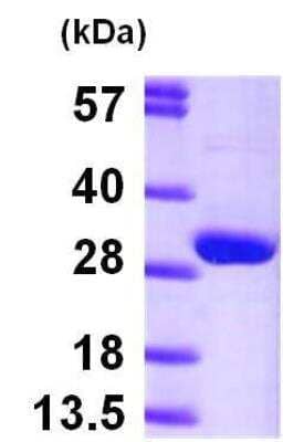 Western Blot: Recombinant Human HPRT His Protein [NBP1-45251]