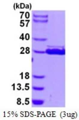 SDS-PAGE: Recombinant Human HSCB His Protein [NBP1-98925]