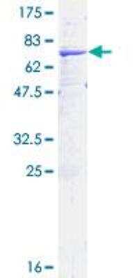 SDS-PAGE: Recombinant Human HSD11B2 GST (N-Term) Protein [H00003291-P01]