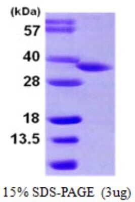 SDS-PAGE: Recombinant Human HSD17B8 His Protein [NBP1-51071]