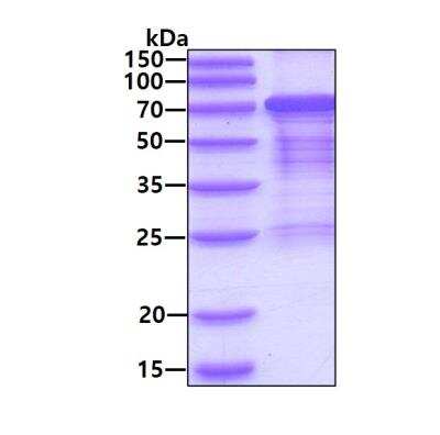 SDS-PAGE: Recombinant Human HSF1 His Protein [NBC1-18373]