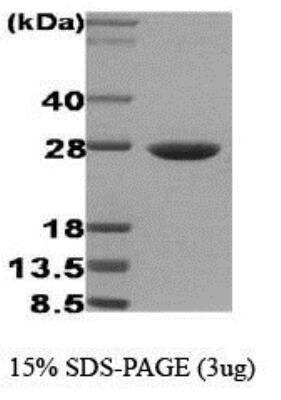 SDS-PAGE: Recombinant Human HSP27 Protein [NBC1-18364]