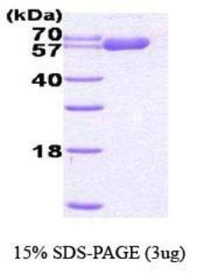 SDS-PAGE: Recombinant Human HSP60 His Protein [NBC1-18372]