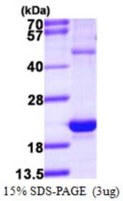 SDS-PAGE: Recombinant Human HSPB3 His Protein [NBP1-78810]