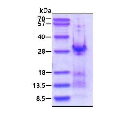 SDS-PAGE: Recombinant Human HSPC111 His Protein [NBP2-23293]