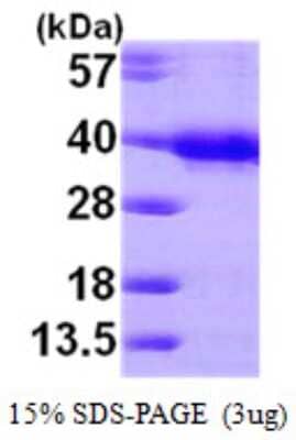 SDS-PAGE: Recombinant Human HUS1 His Protein [NBP1-50899]