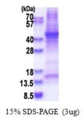 SDS-PAGE: Recombinant Human Haptoglobin His Protein [NBP2-51611]