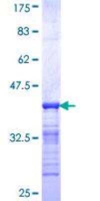 SDS-PAGE: Recombinant Human Helios GST (N-Term) Protein [H00022807-Q01]