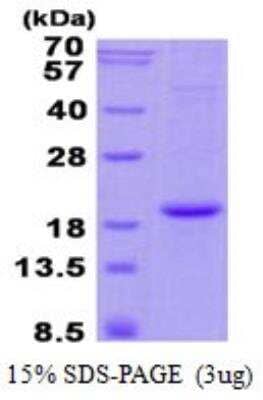 SDS-PAGE: Recombinant Human Hemoglobin A2 His Protein [NBP2-23111]