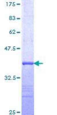 SDS-PAGE: Recombinant Human Hemoglobin beta GST (N-Term) Protein [H00003043-Q01]