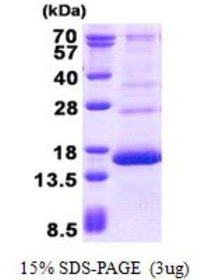 SDS-PAGE: Recombinant Human HBG1/2 His Protein [NBP2-23113]