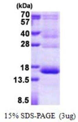 SDS-PAGE: Recombinant Human HBG1/2 His Protein [NBP2-23112]