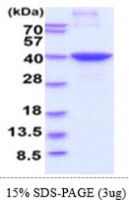 SDS-PAGE: Recombinant Human HLA G His Protein [NBP2-61457]