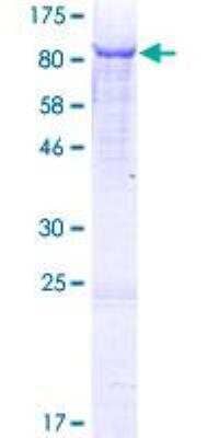 SDS-PAGE: Recombinant Human Histidase GST (N-Term) Protein [H00003034-P01]