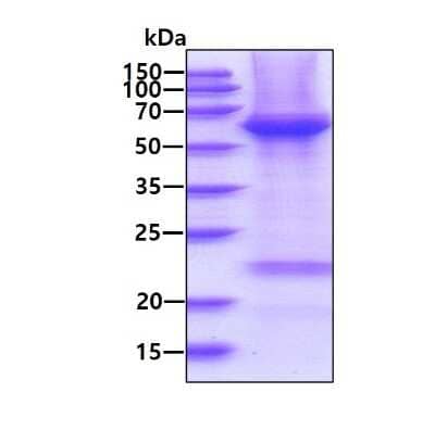 SDS-PAGE: Recombinant Human Histone Deacetylase 2/HDAC2 His Protein [NBP1-72399]