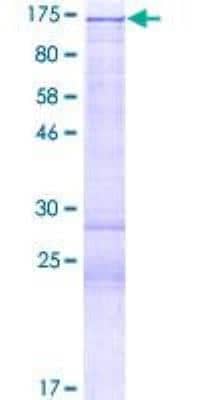 SDS-PAGE: Recombinant Human Histone Deacetylase 4/HDAC4 GST (N-Term) Protein [H00009759-P01]