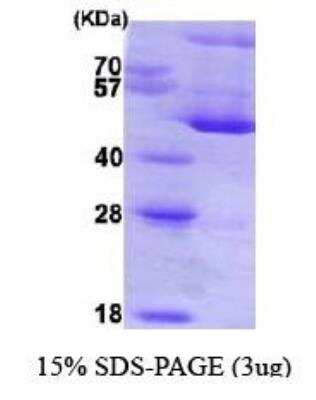 SDS-PAGE: Recombinant Human Hsp47 His Protein [NBC1-22576]