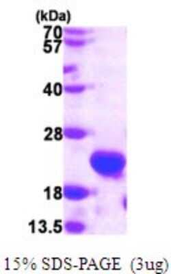 SDS-PAGE: Recombinant Human HspB11 His Protein [NBP1-72308]