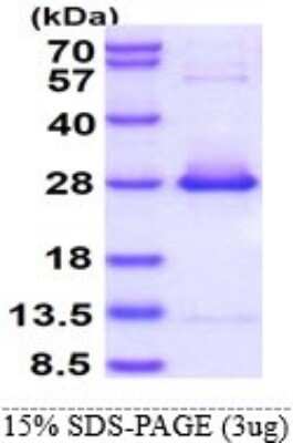 SDS-PAGE: Recombinant Human HspB2 His Protein [NBP1-98978]