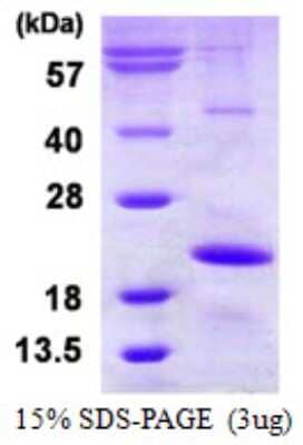 SDS-PAGE: Recombinant Human HspB9 His Protein [NBP1-99033]