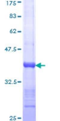 SDS-PAGE: Recombinant Human Huntingtin GST (N-Term) Protein [H00003064-Q01]