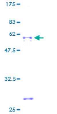 SDS-PAGE: Recombinant Human Hydrogen Potassium ATPase Beta GST (N-Term) Protein [H00000496-P01]