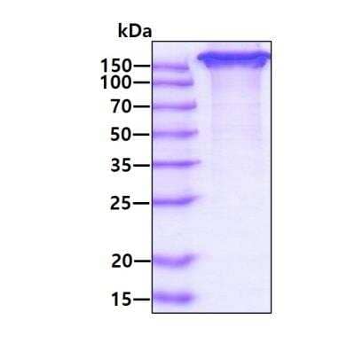 SDS-PAGE: Recombinant Human ICAM-5 hIgG-His Protein [NBP3-05774]