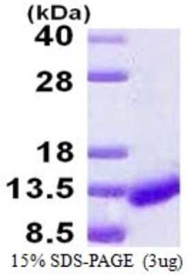 SDS-PAGE: Recombinant Human ICEBERG His Protein [NBP1-98862]