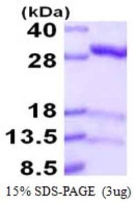 SDS-PAGE: Recombinant Human IDI1 His Protein [NBP1-72516]