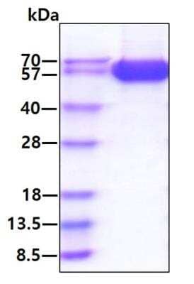 SDS-PAGE: Recombinant Human IFN-alpha/beta R1 His Protein [NBP2-77487]