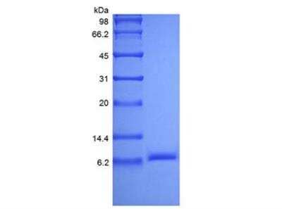 SDS-PAGE: Recombinant Human IGF-II/IGF2 Protein [NBP2-59722]