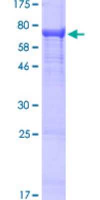 SDS-PAGE: Recombinant Human IGHV4-31 GST (N-Term) Protein [H00028396-P02]