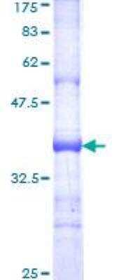 SDS-PAGE: Recombinant Human IGSF10 GST (N-Term) Protein [H00285313-Q01]