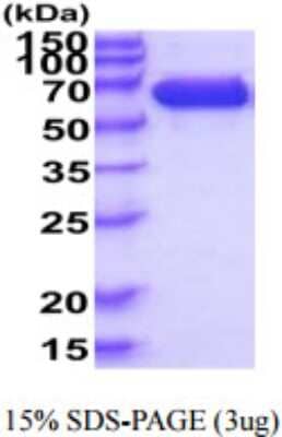 SDS-PAGE: Recombinant Human IGSF8/CD316 His Protein [NBP2-59888]