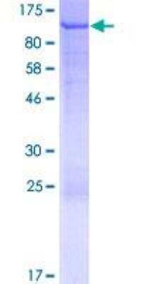 SDS-PAGE: Recombinant Human IKB zeta GST (N-Term) Protein [H00064332-P01]