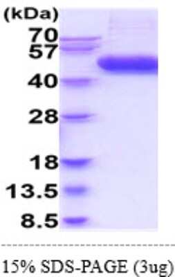 SDS-PAGE: Recombinant Human IL-1 RII Isoform 1 His Protein [NBP2-61984]