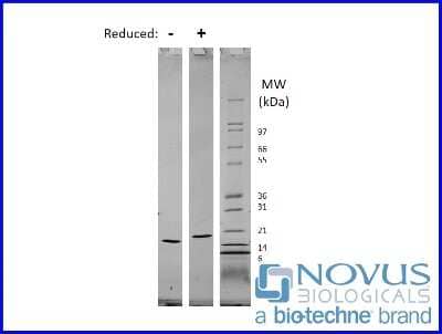 SDS-PAGE: Recombinant Human IL-10 Animal-Free Protein [NBP2-76208]