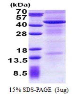 SDS-PAGE: Recombinant Human IL-13R alpha 2 His Protein [NBP2-23147]