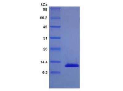 SDS-PAGE: Recombinant Human IL-13 Variant Protein [NBP2-35024]