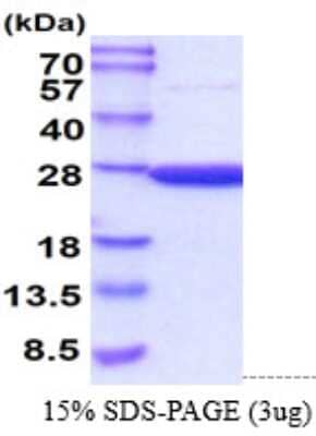 SDS-PAGE: Recombinant Mouse Peroxiredoxin 2 His Protein [NBP2-61185]