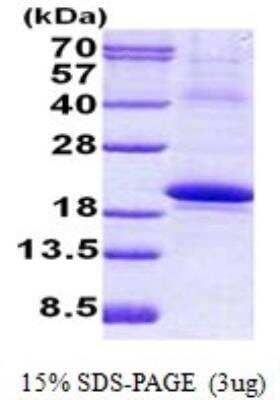 SDS-PAGE: Recombinant Human IL-18 BPa/IL18BP His Protein [NBP2-23150]