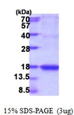 SDS-PAGE: Recombinant Mouse IL-18/IL-1F4 Protein [NBP2-59520]