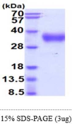 SDS-PAGE: Recombinant Human IL-4R alpha His Protein [NBP2-61210]