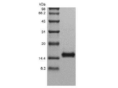 SDS-PAGE: Recombinant Human IL-22 Protein [NBP2-34861]