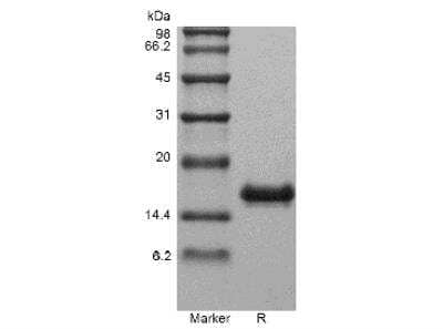 SDS-PAGE: Recombinant Human IL-31 Protein [NBP2-34870]