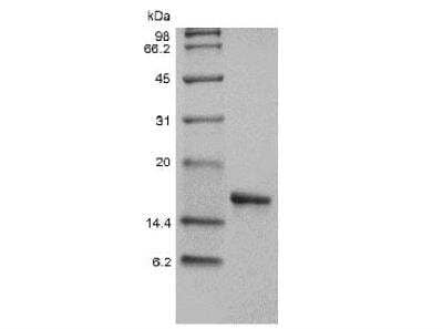 SDS-PAGE: Recombinant Human IL-36 alpha/IL-1F6 Protein [NBP2-34876]